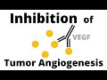 Tumor Angiogenesis Prevention Strategies Quiz