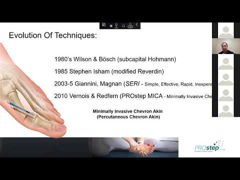 PROstep™ MIS Webinar: Our Experience with these Revitalized Techniques featuring Drs. Davis and Kane