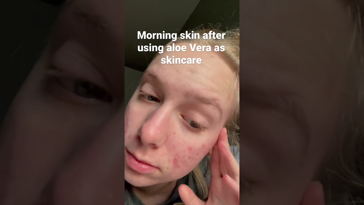 My skin has never been so healthy 