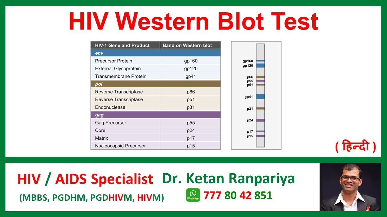 Understanding the HIV Western Blot Test: Accuracy, Results & What it Means for You