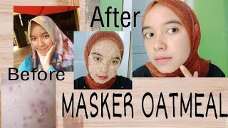 Masker Oatmeal Untuk Memutihkan Wajah Dan Menghilangkan Bekas Jerawat #tipsanti