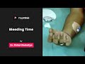 Bleeding time  dr shital ghataliya  physiology prepclinic