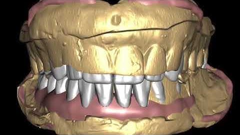 Máy scan 3D Nha khoa | Máy quét 3D nha khoa | Shining 3D Dental | MÁY IN 3D NHA KHOA