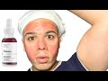 THE ORDINARY AHA 30% + BHA 2% PEELING SOLUTION REVIEW