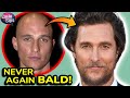 Matthew mcconaughey  what is the real reason for the actors affair of his hair