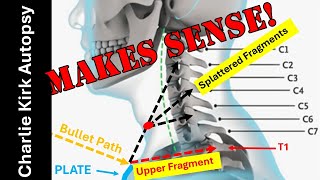 Charlie Kirk Autopsy:  Make Sense?