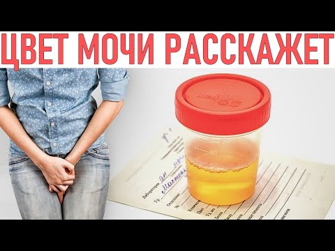 МОЧА ВО ВРЕМЯ БЕРЕМЕННОСТИ | О чем расскажет цвет мочи при беременности