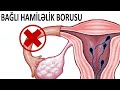 Bağlı hamiləlik boruları - Açılması mümkündürmü?