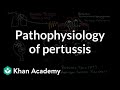 Understanding Pertussis: A Comprehensive Quiz