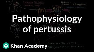 Pathophysiology of pertussis | Respiratory system diseases | NCLEXRN | Khan Academy