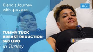 🇷🇴 Elena's 360 Liposuction & Breast Reduction & Tummy Tuck Journey in Turkey | Flymedi Success Story