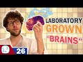 Scientists Grow Mini Brains in the Laboratory! | Brain organoids