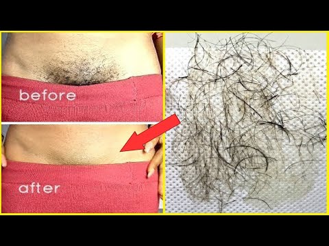 PUBIC HAIR REMOVAL HOME REMEDIES: How To Remove Pubic Hair Naturally With No Pain (Works 100%)