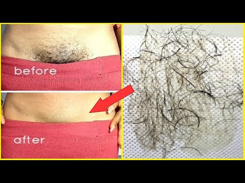 زیر ناف بالوں کو ہٹانے کے گھریلو علاج: بغیر درد کے قدرتی طور پر زیر ناف بال کیسے ہٹائیں (100% کام کرتا ہے)
