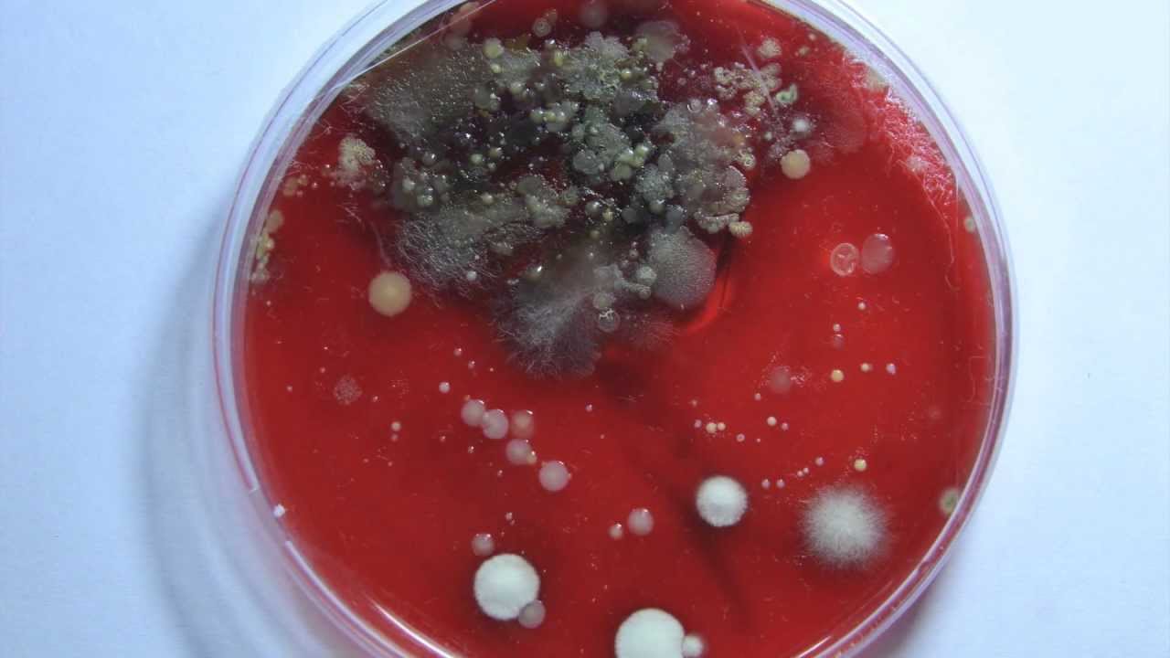 Bacteria Growth Time Lapse - YouTube