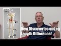 New Discoveries on Leg Length Difference