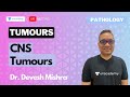 CNS Tumours with Dr. Devesh Mishra