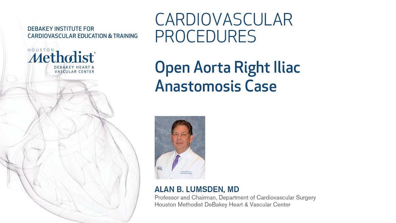 Open Aorta Right Iliac Anastomosis Case - Part 3 of 4 (ALAN B. LUMSDEN, MD) education film