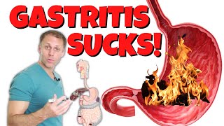 Gastritis  A Different Viewpoint