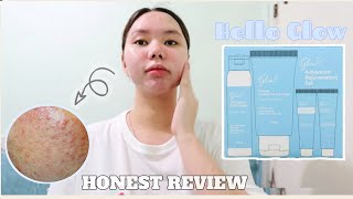 10 weeks using HELLO GLOW Advanced Rejuvenating set   SKINCARE GIVEAWAY 🎉