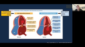 2023 CRT: 50 Shades of MAC - Management Options