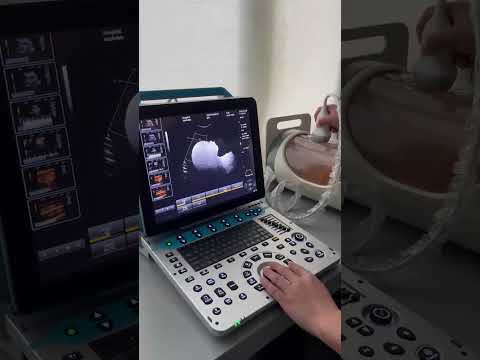 Medical 3D 4D 5D Portable Color Ultrasound System YSB-P30 - video from Yuesen Med