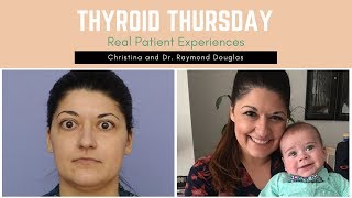 Christina's Thyroid Eye Disease Journey | Dr. Raymond Douglas