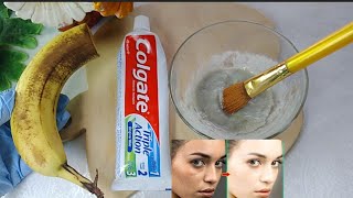 Mix banana and toothpaste A recipe for skin whitening skincare