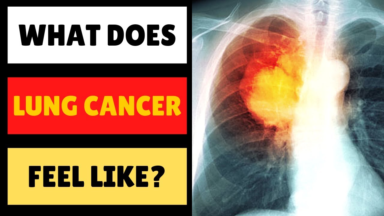 What Does Lung Cancer Feel Like [FULL EXPLANATION] - YouTube