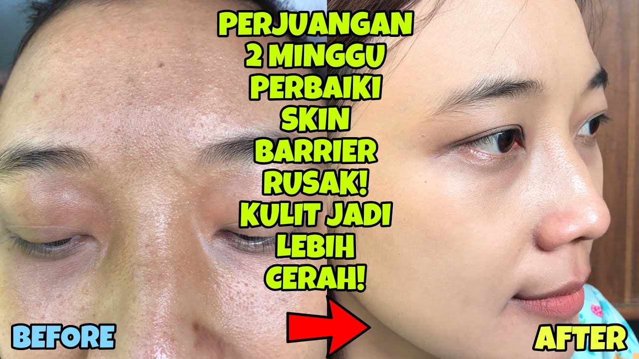 CUMA 14 HARI!!! TERAMPUH PERBAIKI SKIN BARRIER DAN BIKIN WAJAH JADI