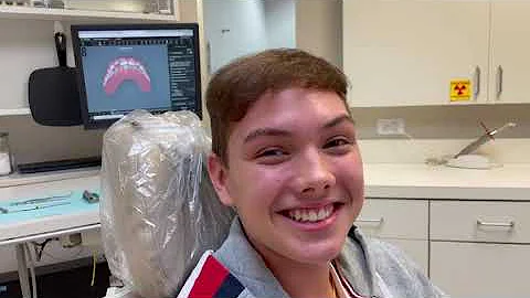 Amazing Invisalign Results by Dr. Susan Ellison | ...