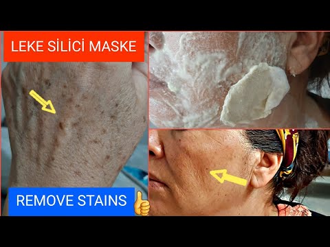 MY MOTHER LOOKS 10 YEARS YOUNGER 😲 GET RID OF STAINS WITH STAIN REMOVER POTATO MASK STRETCH HER SKIN