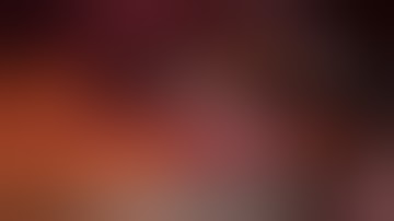 Gastric Schwannoma - video