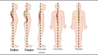 Вебинар по выравниванию спины 2021