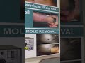 ADITYA SKIN CLINIC &amp; LASER CENTRE | DR PRIYANK SEN | WAGHODIA ROAD | VADODARA