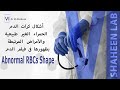أشكال كرات الدم الحمراء الغير طبيعية والأمراض المرتبطة بظهورها فى فيلم الدم Abnormal RBCs Morphology 