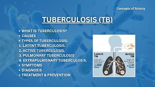 Tuberculosis (TB) - Causes, Treatment, Prevention, Transmission.