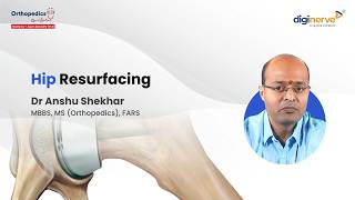 Hip Resurfacing Explained | Preoperative Templating &amp; Component Positioning | Orthopedics NEET SS
