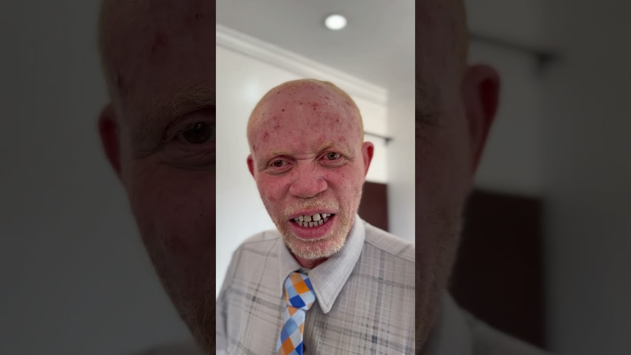 Flipping the script on old fairness cream ads. Dilli Dark coming to the theatre may 23rd !! 