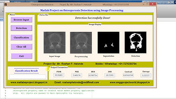 Matlab Code for Osterporosis Detection using Image Processing