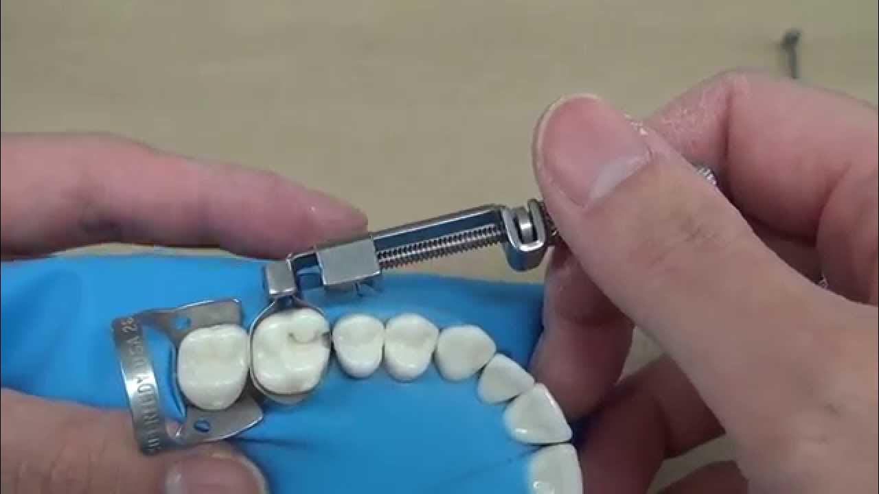 Placement of Tofflemire matrix band YouTube