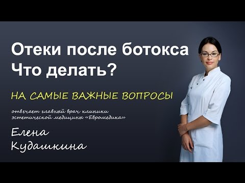 Отеки после ботокса. Что делать?