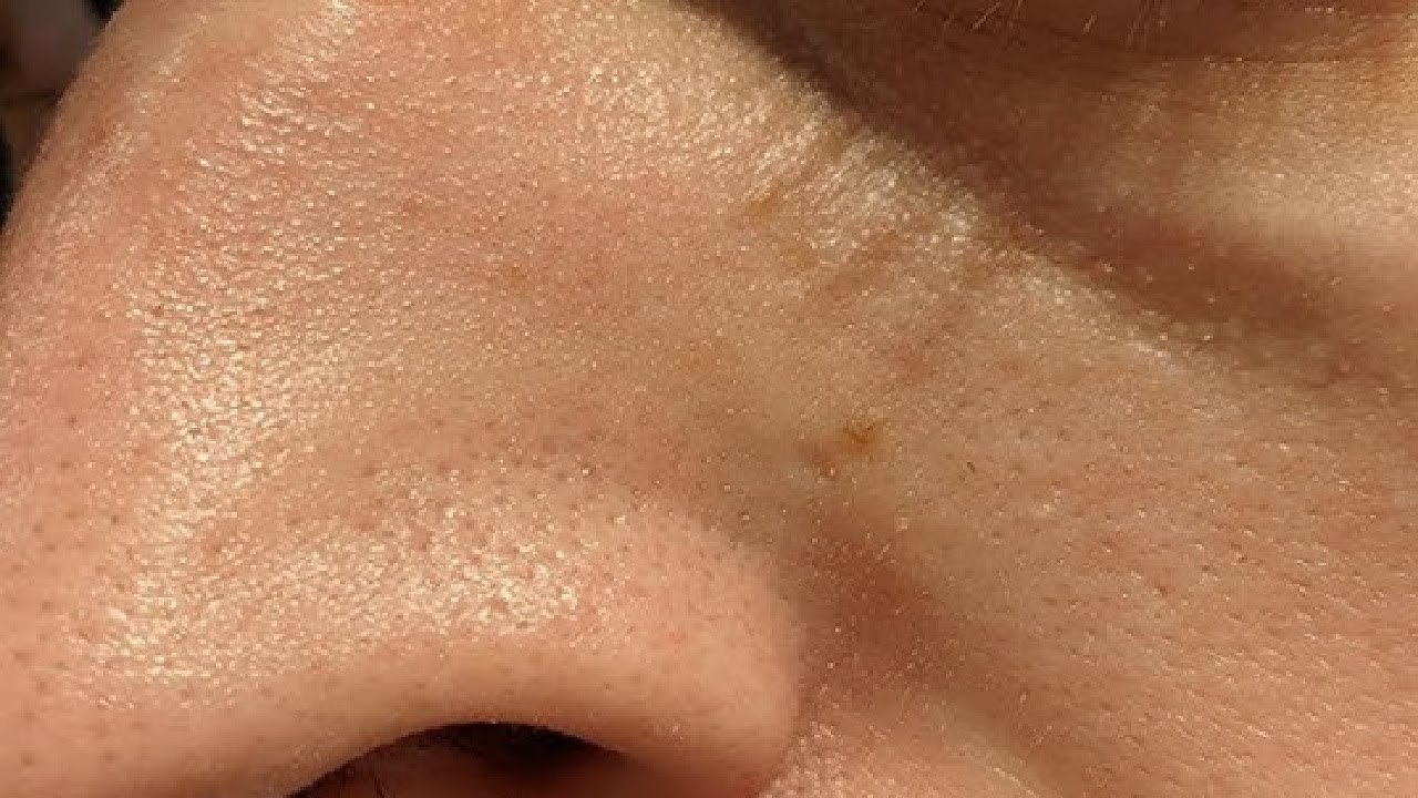 why does my face burn when i use moisturizer easy fix