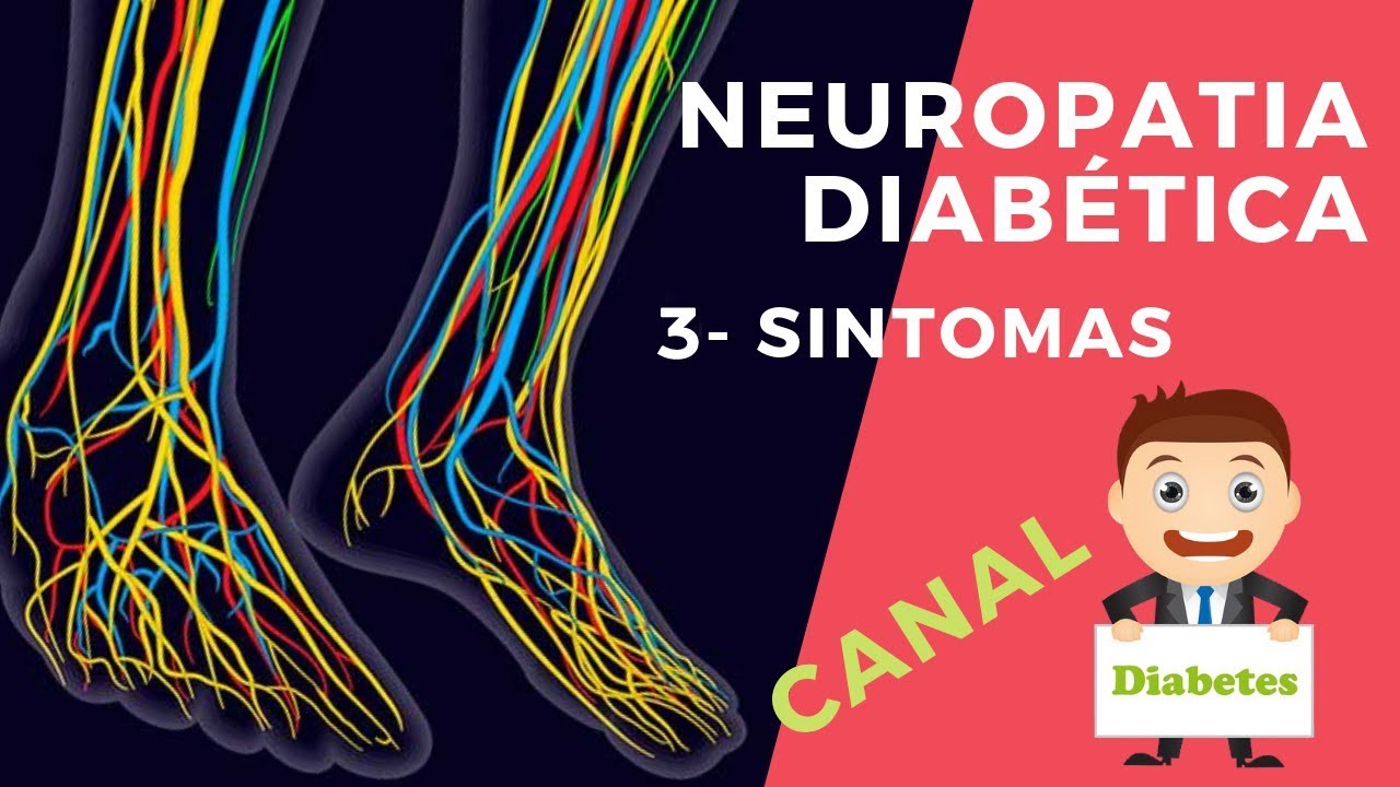 Fisioterapia do nervo femoral