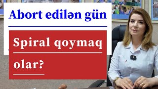 Abortdan Həmən Sonra Spiral Qoymaq