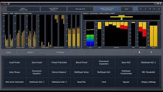 Omnia.9/XE - Comp6 (Preset Jovem)