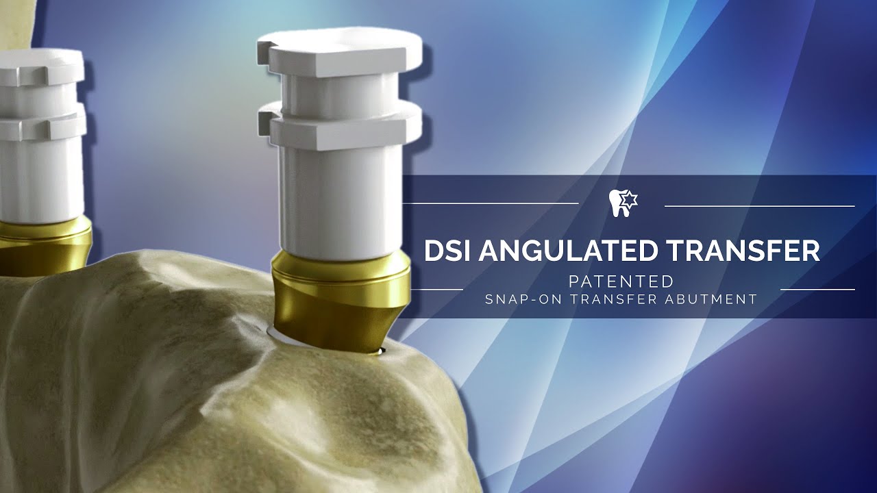 DSI Patented Angulated Impression Snap-on Transfer Abutment - teaser into video