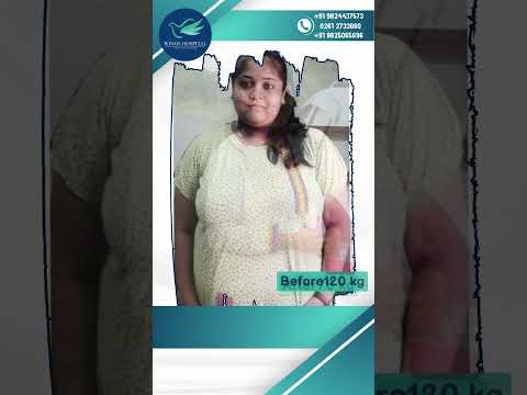 Types of Bariatric Surgery - Which Weight Loss Procedure Is Right for You?