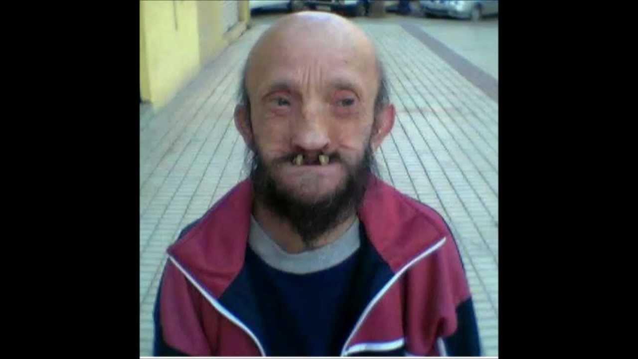 Die 10 hässlichsten Menschen der Welt YouTube