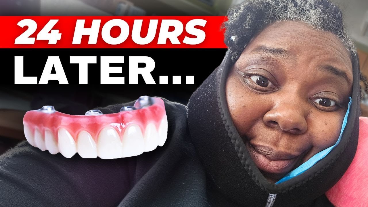 What No One Told Me About 24-Hour Dental Implant Recovery